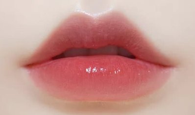 做丰唇要多少钱