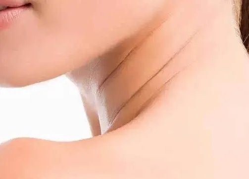 颈部祛皱效果好吗