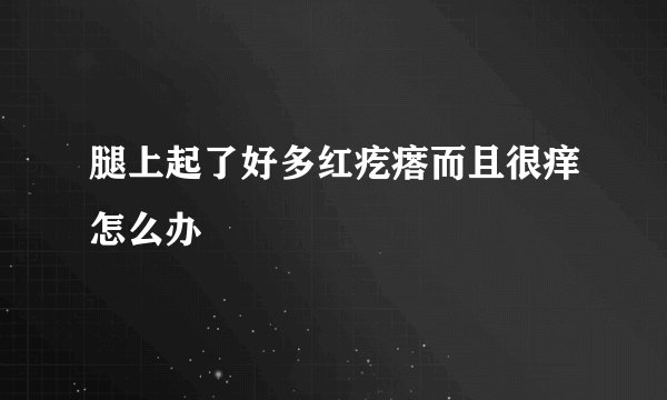 腿上起了好多红疙瘩而且很痒怎么办