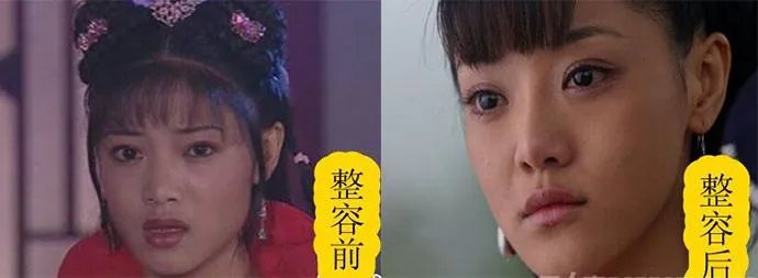 邓家佳整容前后照片 爱美之心人皆有之