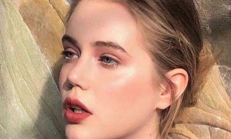 opt嫩肤的注意事项