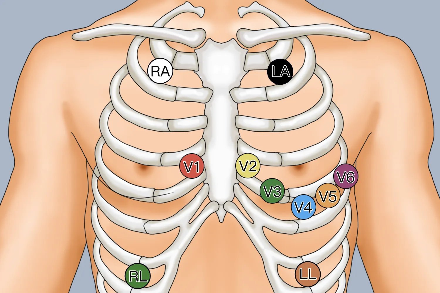 24小时动态心电图佩戴部位图