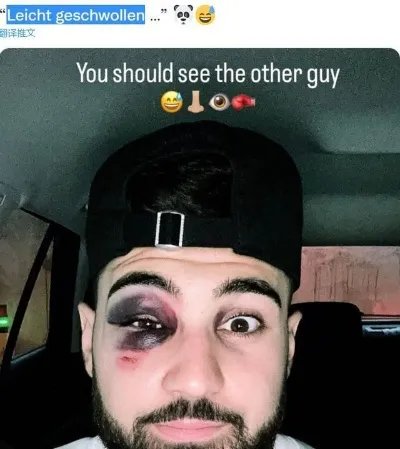 僵tvb国语粤语中字_僵tvb国语电影免费在线