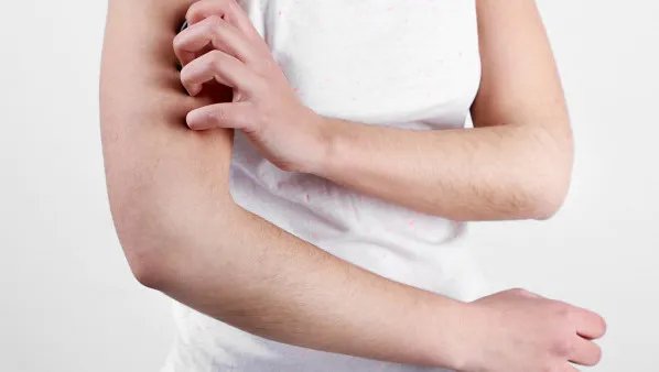 皮肤阳光过敏怎么办