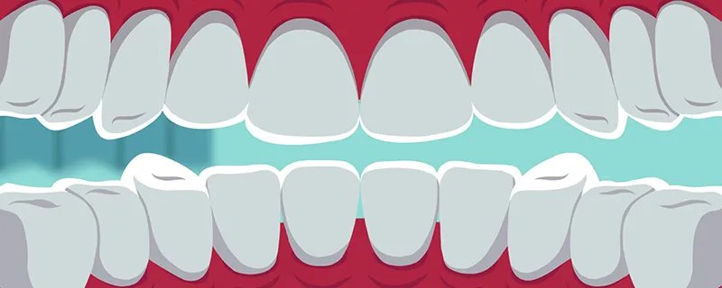 普通烤瓷牙的危害