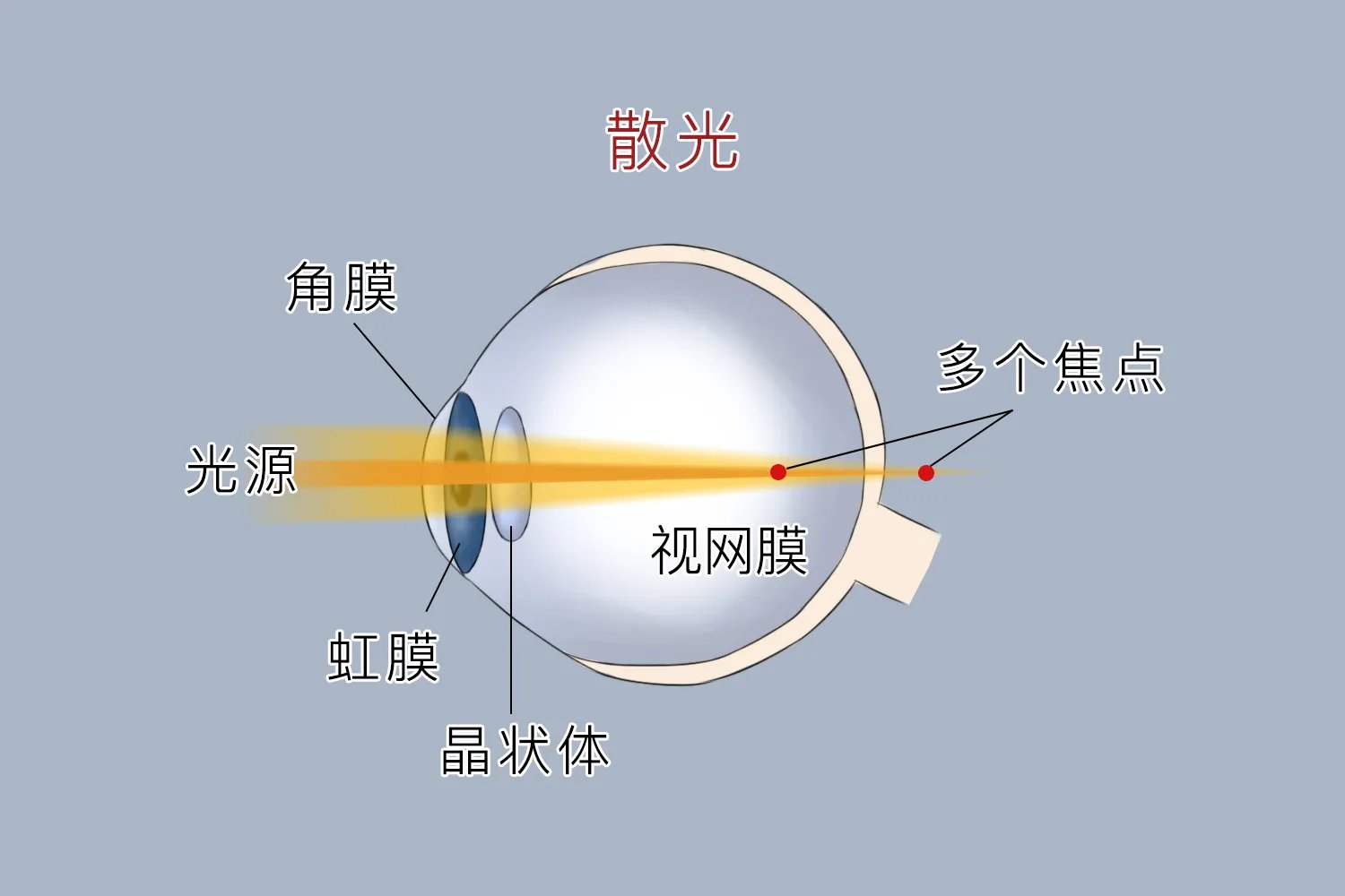 散光成像示意图