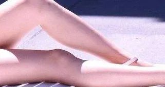 共振抽脂大概多少钱