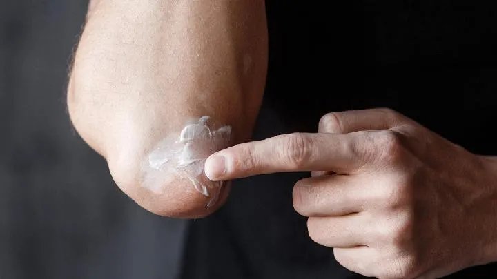 关于白癜风传染么