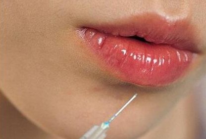 什么是微整形美容