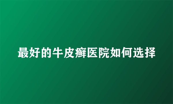 最好的牛皮癣医院如何选择