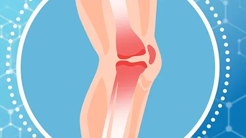 紫癜会有什么症状