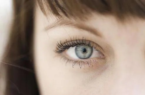 13mm大宽双眼皮多久恢复