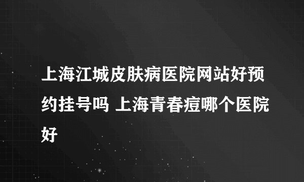 上海江城皮肤病医院网站好预约挂号吗 上海青春痘哪个医院好
