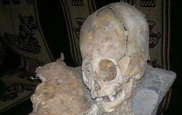 巨头干尸是什么:疑似外星人的干尸,头骨比人类大很多