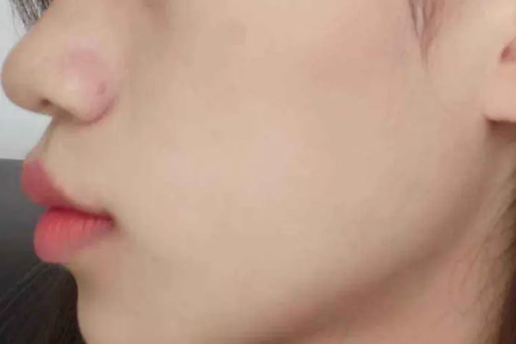 正常嘴唇侧面图