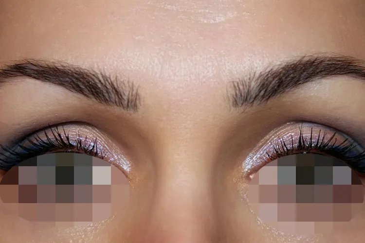 双眼皮类型及图片大全