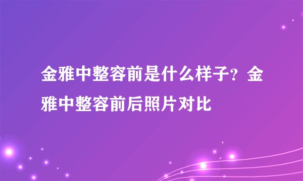 金雅中整容前是什么样子？金雅中整容前后照片对比