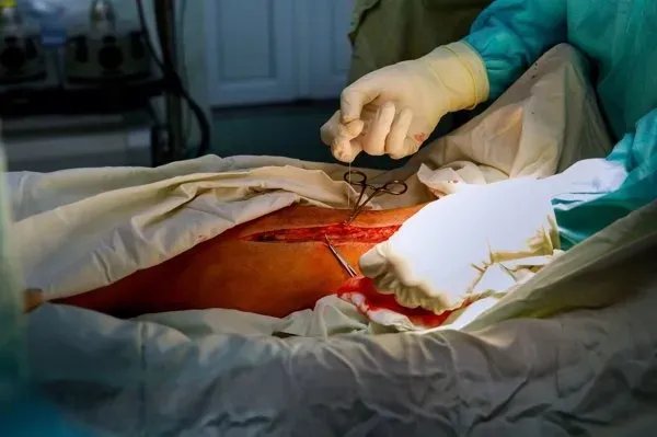 株洲无痛人流手术多少钱