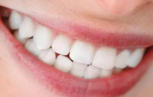 牙齿断了一半补牙多少钱