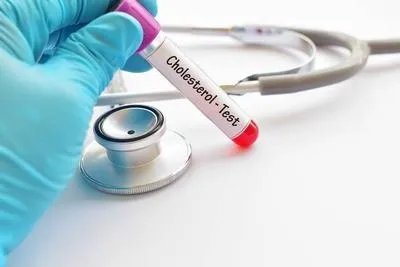 血尿酸高是怎么形成的 血尿酸高的6个原因好好分析下