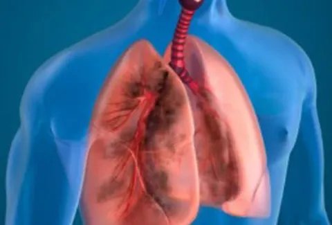 江苏师大学生称曾被警告别乱说话,这是要挟吗?