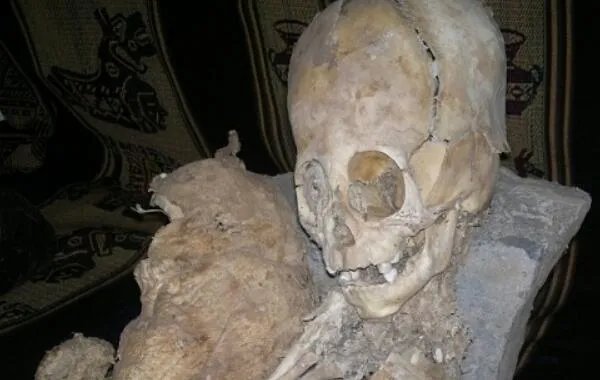 巨头干尸是什么:疑似外星人的干尸,头骨比人类大很多