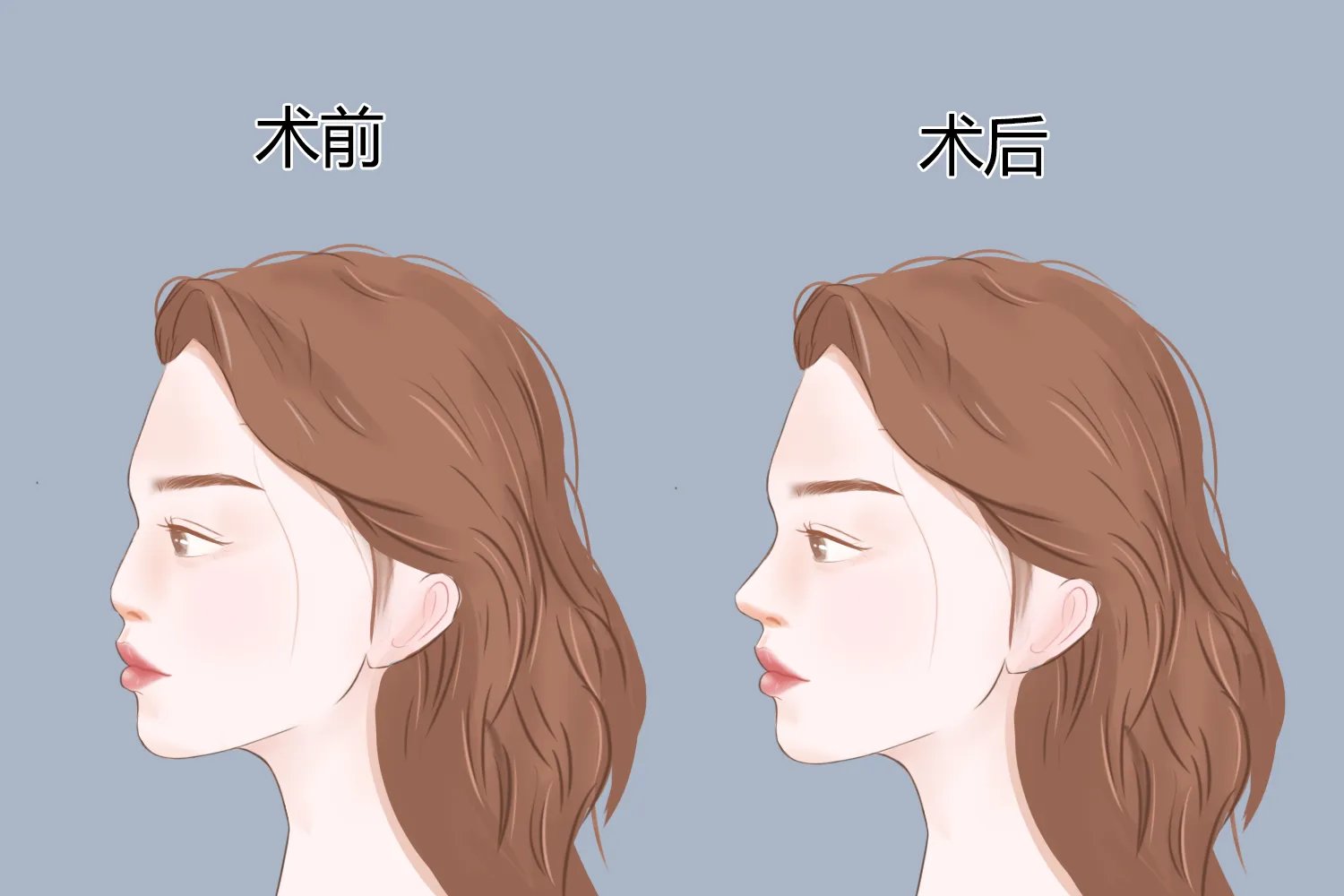 面部整形部位图解