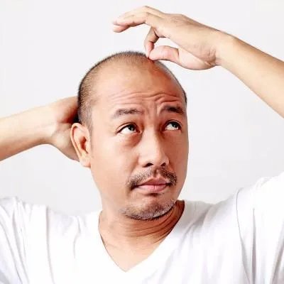 用生姜如何治疗脱发