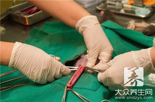 梅艳芳为什么不做手术