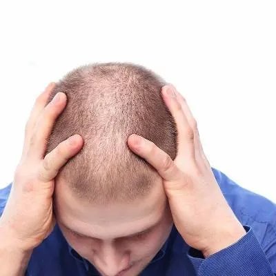 哪种洗发水防脱发