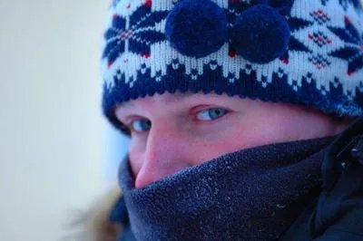 脸部红血丝症状怎么办