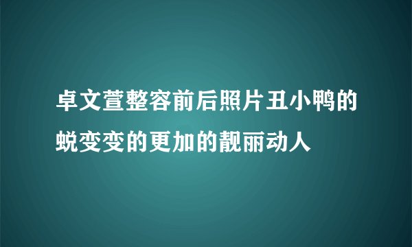 卓文萱整容前后照片丑小鸭的蜕变变的更加的靓丽动人