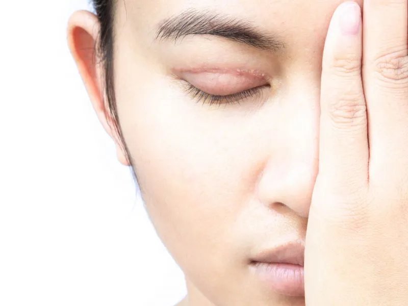 除鱼尾纹哪里好