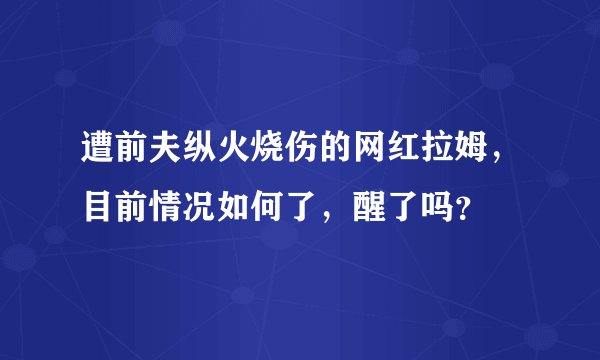 遭前夫纵火烧伤的网红拉姆,目前情况如何了,醒了吗?