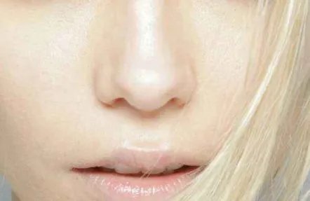 鼻头鼻翼缩小要多少钱