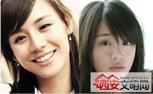 马思纯整容前后:被人感叹惊为天人