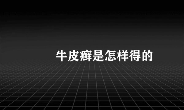 　　牛皮癣是怎样得的