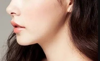 垫下巴假体的注意事项