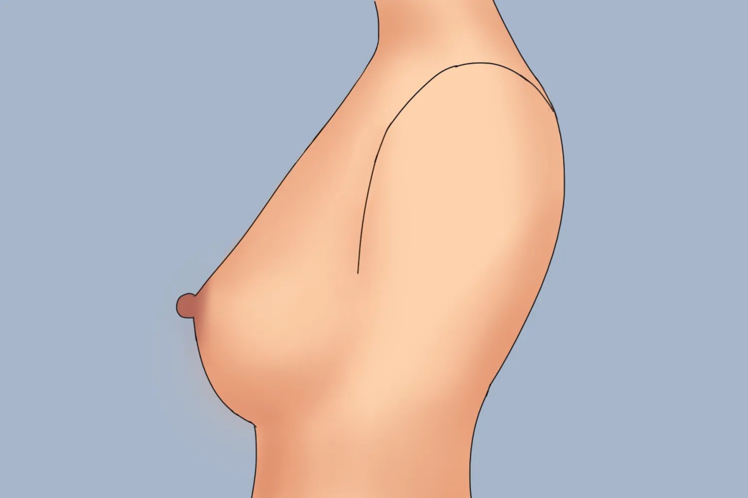 胸型有哪几种胸型分类图