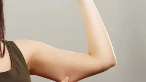 胳膊脱毛要多少钱