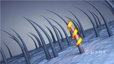 脂溢性脱发如何生发