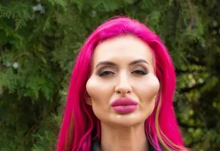 网红自称拥有世界最大脸颊，你觉得她为何会沉迷于整形？