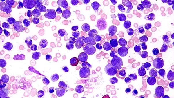 进口食品核酸阳性不代表会传染 雪糕中检测出新冠病毒是真的吗？