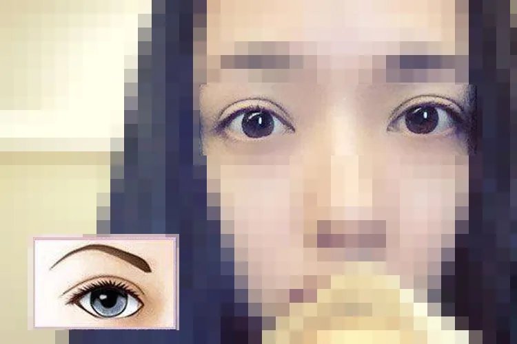 双眼皮类型及图片大全