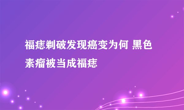 福痣剃破发现癌变为何 黑色素瘤被当成福痣