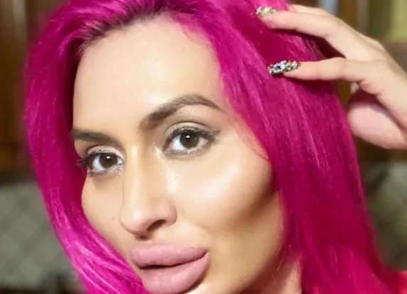 网红自称拥有世界最大脸颊，你觉得她为何会沉迷于整形？