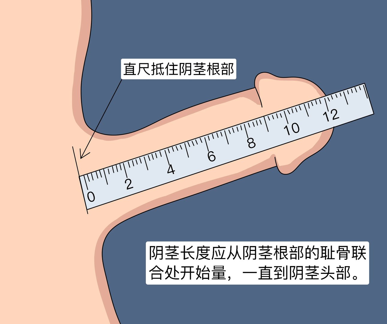 阴茎的长度怎么测