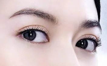 兰州做韩式三点双眼皮多少钱