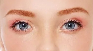 双眼皮恢复多久