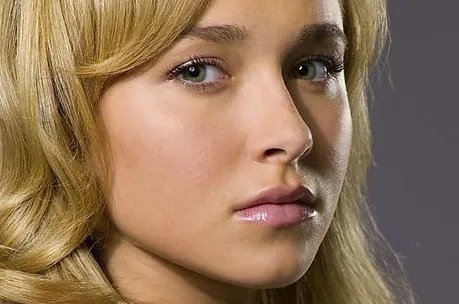 除皱整形的费用是多少